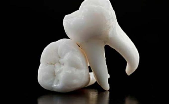 Китайские ученые вырастили зуб из мочи